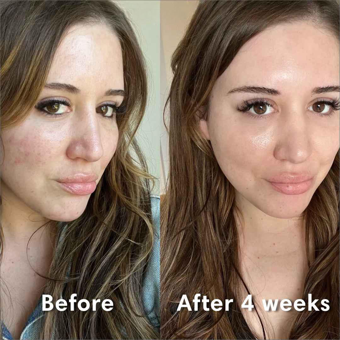 CollagenDreams™ masker | Essentiële hydratatie voor de huid tijdens het slapen!