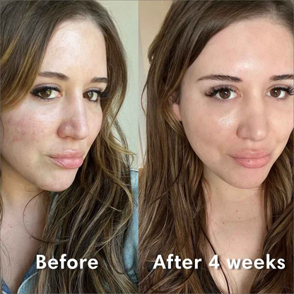 CollagenDreams™ masker | Essentiële hydratatie voor de huid tijdens het slapen!