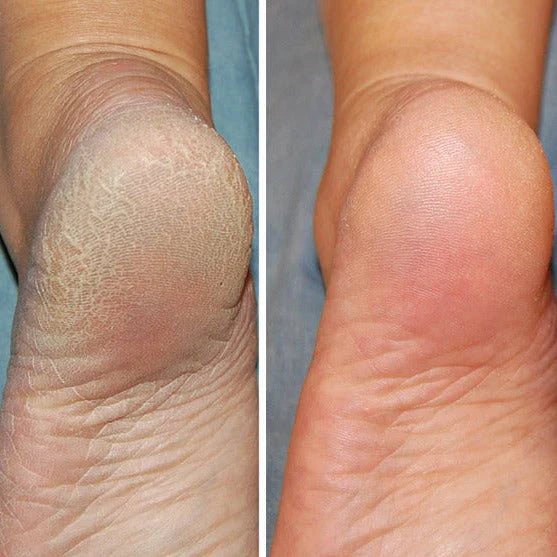 Bayline™ | Pedicure Silicone Sokken